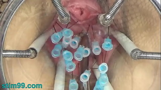 Extreme German Sadism & masochism Wide a flap inside Cunt Cervix and Special